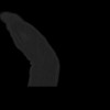 SPORK, NICO - 22.03.1976 - 02.08.2022 - CT obere Extremität - 18:01:46